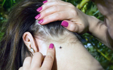 Vrijeme ujeda krpelja – oprez neophodan zbog Lajmske bolesti