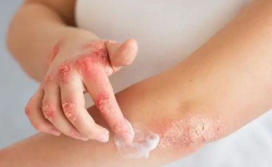 Škola atopije u Foči